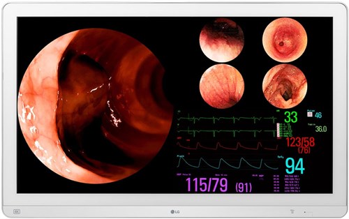 LG 32HL710S-W LED display 80 cm (31.5") 3840 x 2160 Pixels 4K Ultra HD Zilver, Wit